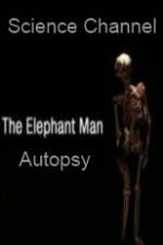 Watch Science Channel Elephant Man Autopsy Goojara