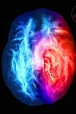 Watch Brain on Fire Goojara