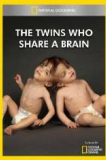 Watch National Geographic The Twins Who Share A Brain Goojara