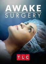 Watch Awake Surgery Goojara