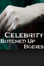 Watch Celebrity Botched Up Bodies Goojara
